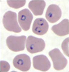 20110306-malaria cdc  falciparum.jpg